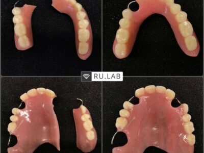 Зубной протезист в Георгиевске